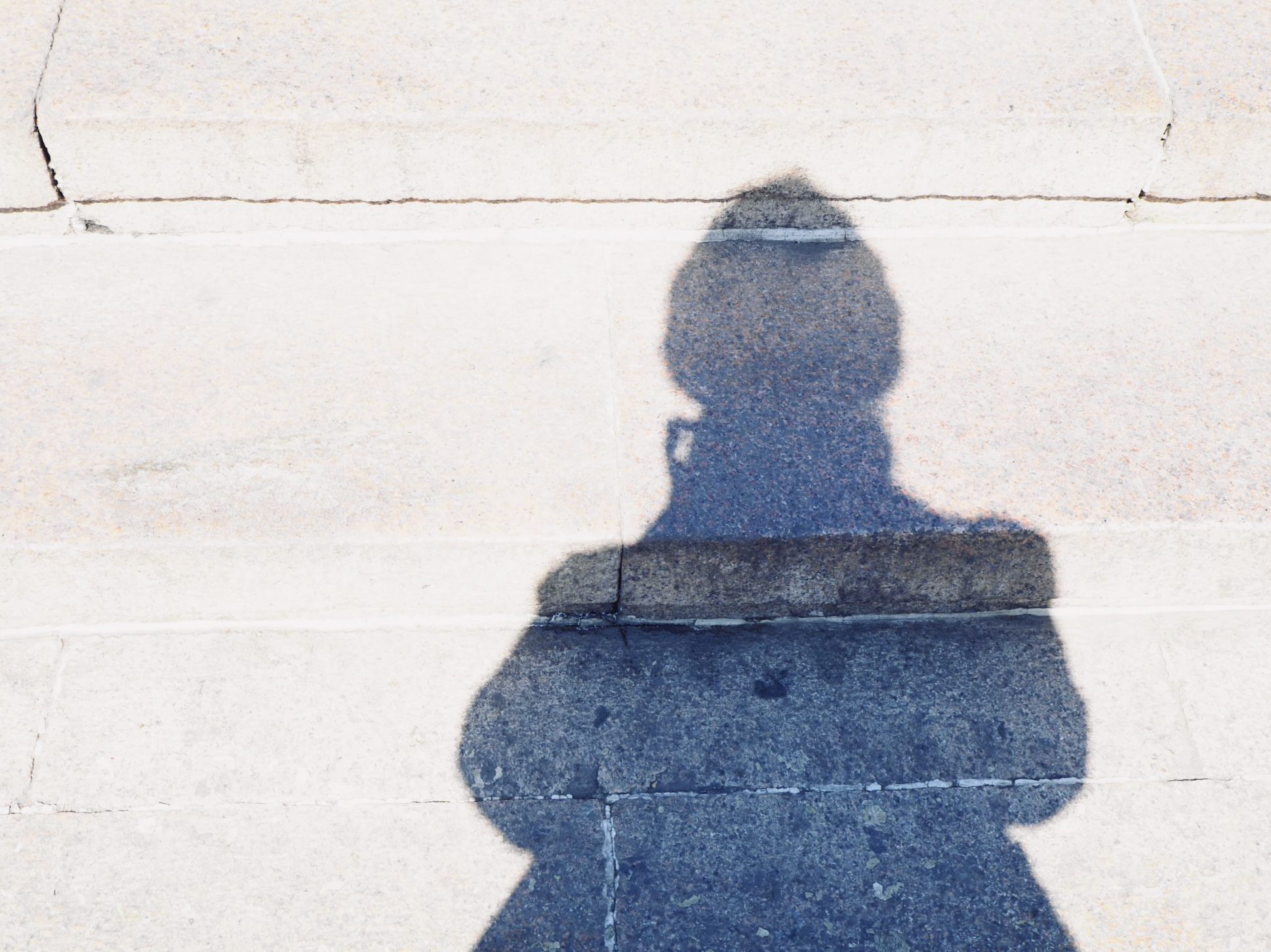 白內(nèi)障手術(shù)